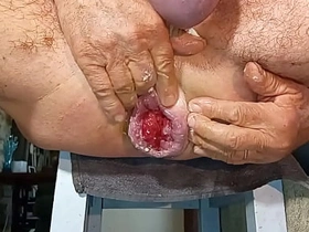 扩肛侠2025-14 asian hard gay sex videos