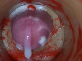 内射实录——体内镜头捕捉男性深喉射精 asian cute gay sex videos