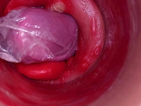 深入阴道的摄像头记录下带着套套的巨量射精 asian gay boys sex videos in hd